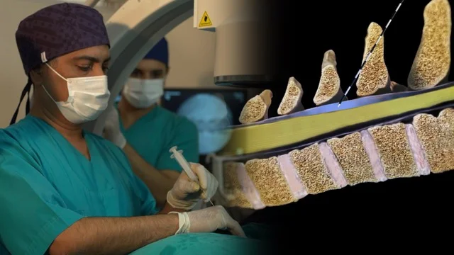 Boyun Fıtığında Nokta Atışı Tedavisi (Servikal Epidural Enjeksiyon)