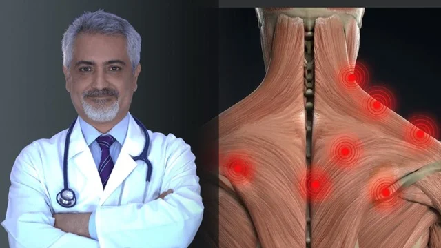 Op. Dr. M. Levent Deniz ve fibromiyaljide boyun, omuz ve sırtta yaygın ağrı noktalarını gösteren kas anatomisi çizimi