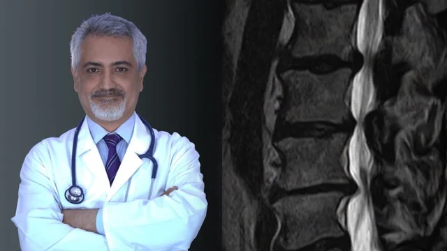 Lumbale Spinalkanalstenose und ihre Behandlung